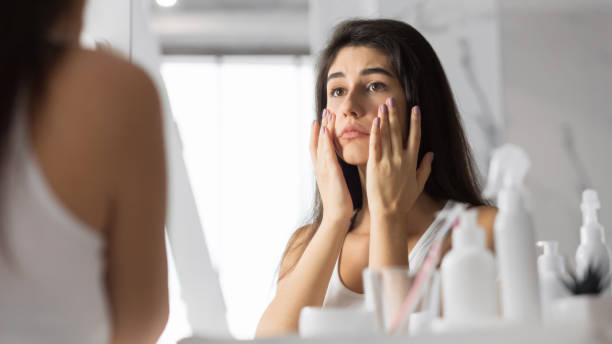 HOW TO PREVENT SKIN DISCOLORATION